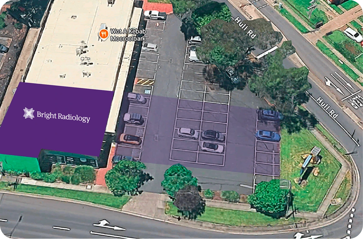Bright Radiology Mooroolbark - Easy On-Site Parking